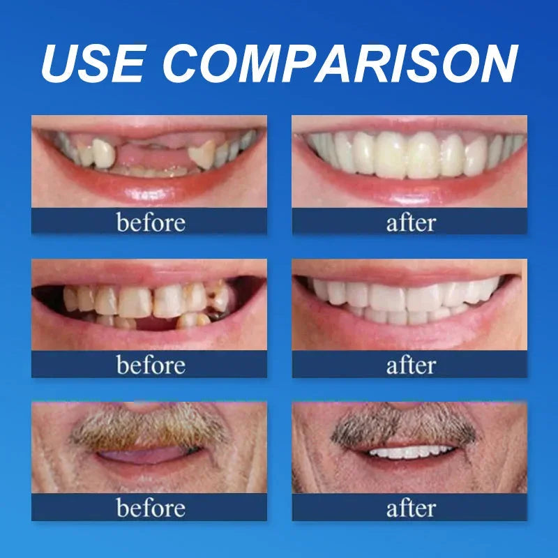 Medazy™-Advanced Custom-Fit Functional Dentures 😁 Smile with Confidence