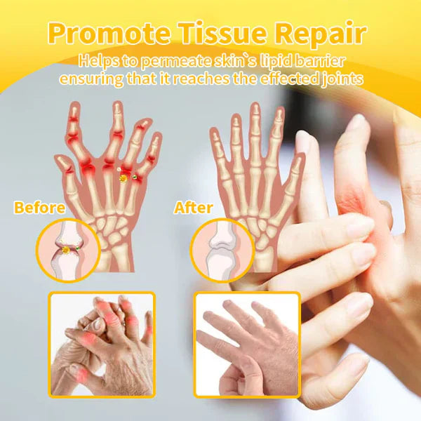 👩⚕️👩⚕️LOVILDS™ 𝐁𝐞𝐞 𝐕𝐞𝐧𝐨𝐦 𝐀𝐝𝐯𝐚𝐧𝐜𝐞𝐝 𝐉𝐨𝐢𝐧𝐭 𝐚𝐧𝐝 𝐁𝐨𝐧𝐞 𝐓𝐡𝐞𝐫𝐚𝐩𝐲 𝐂𝐫𝐞𝐚𝐦 (𝐍𝐞𝐰 𝐙𝐞𝐚𝐥𝐚𝐧𝐝 𝐁𝐞𝐞 𝐄𝐱𝐭𝐫𝐚𝐜𝐭 - 𝐒𝐩𝐞𝐜𝐢𝐚𝐥𝐢𝐳𝐞𝐬 𝐢𝐧 𝐎𝐫𝐭𝐡𝐨𝐩𝐞𝐝𝐢𝐜 𝐃𝐢𝐬𝐞𝐚𝐬𝐞𝐬 𝐚𝐧𝐝 𝐀𝐫𝐭𝐡𝐫𝐢𝐭𝐢𝐬 𝐏𝐚𝐢𝐧)