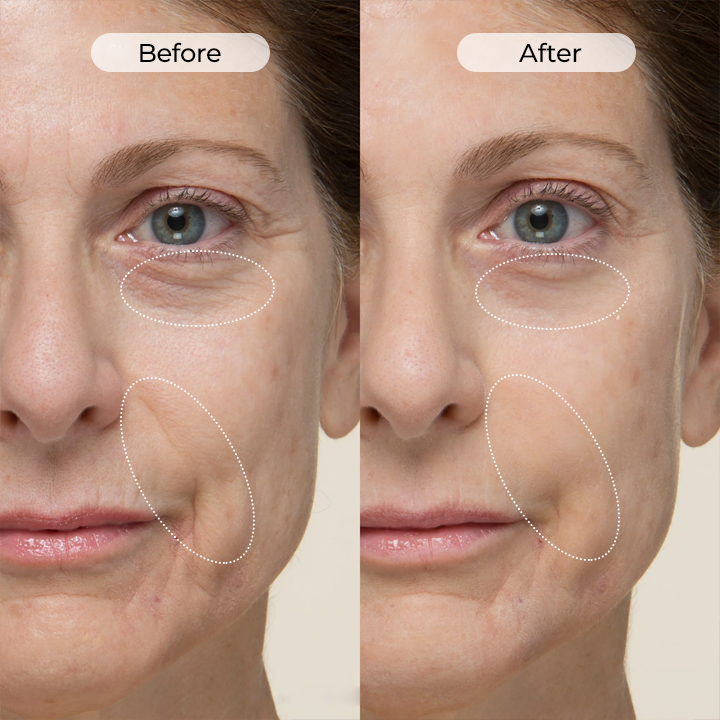 LOVILDS™ TightShift Precision Contour & Firming Serum