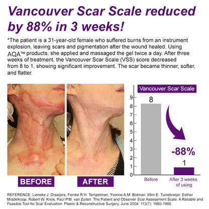 ššUKCA-CERTIFIED ā
AQA⢠cure FACE & BODY SCAR GEL ā Clinically proven to soften, flatten and fade surgical scars, acne marks, burns, keloids and trauma-related scars.