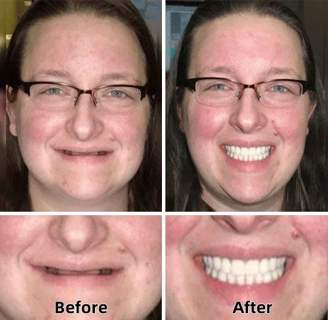 Medazy™-Advanced Custom-Fit Functional Dentures 😁 Smile with Confidence