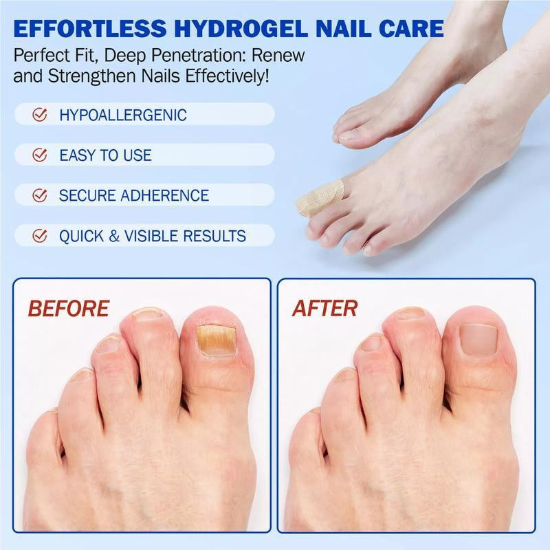 Fungal Nails? This Patch Solves It with Ease! ✅24pcs/box
