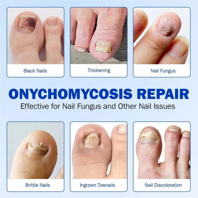 Fungal Nails? This Patch Solves It with Ease! ✅24pcs/box
