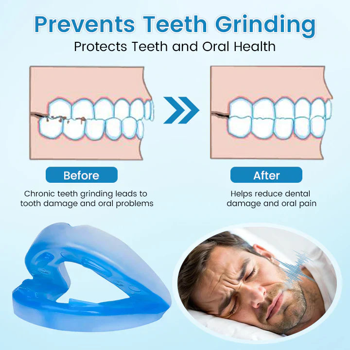 Adjustable Anti-Snoring Mouthpiece