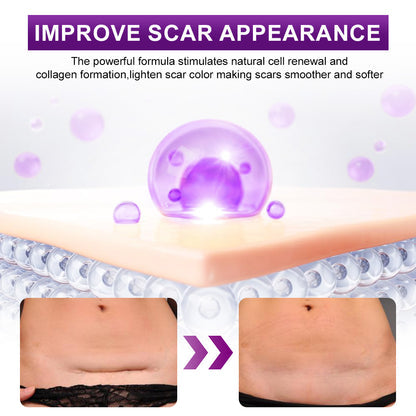 ššUKCA-CERTIFIED ā
AQA⢠cure FACE & BODY SCAR GEL ā Clinically proven to soften, flatten and fade surgical scars, acne marks, burns, keloids and trauma-related scars.