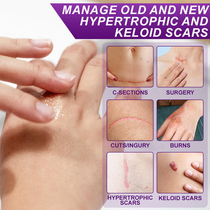 ššUKCA-CERTIFIED ā
AQA⢠cure FACE & BODY SCAR GEL ā Clinically proven to soften, flatten and fade surgical scars, acne marks, burns, keloids and trauma-related scars.