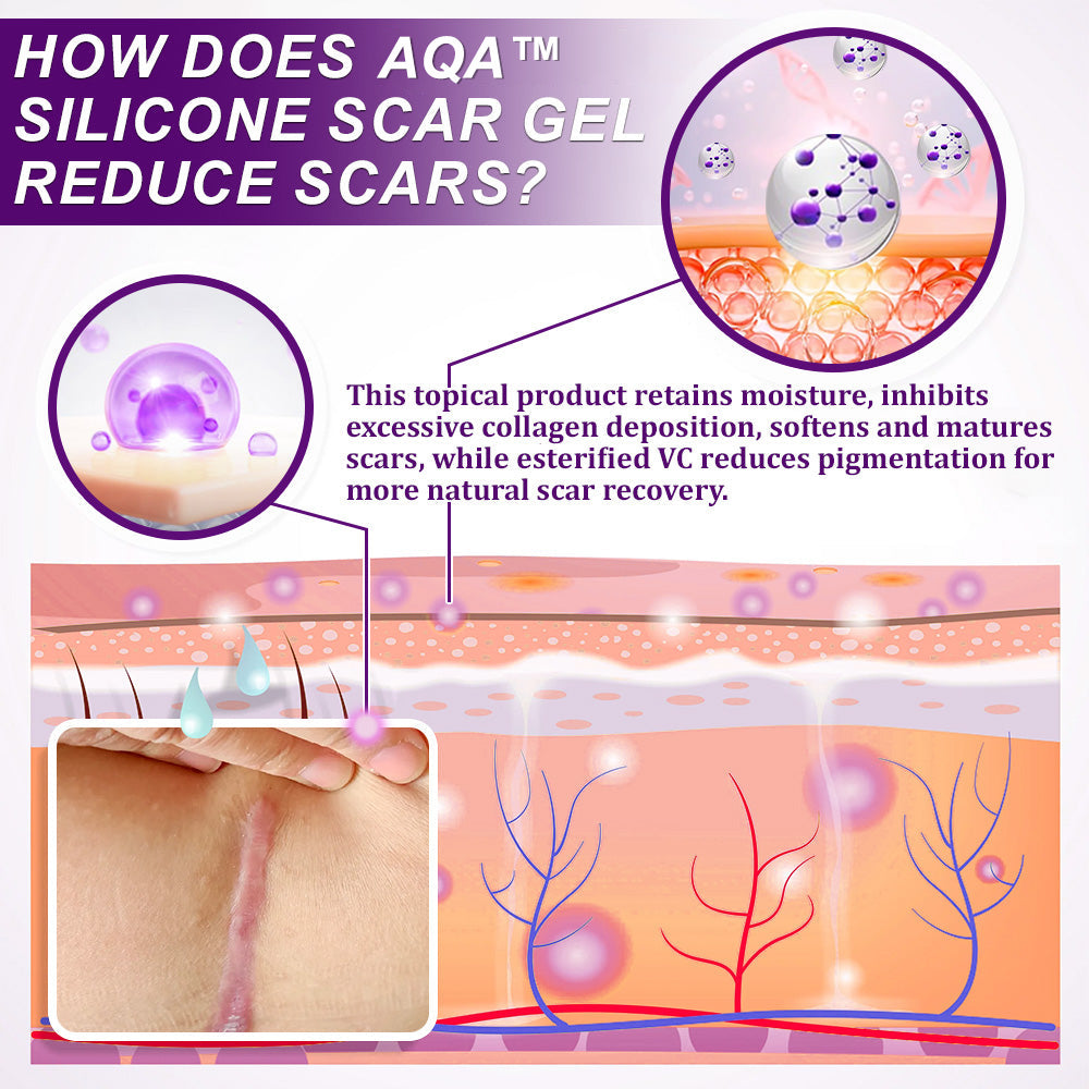 💙💙UKCA-CERTIFIED ✅AQA™ cure FACE & BODY SCAR GEL – Clinically proven to soften, flatten and fade surgical scars, acne marks, burns, keloids and trauma-related scars.