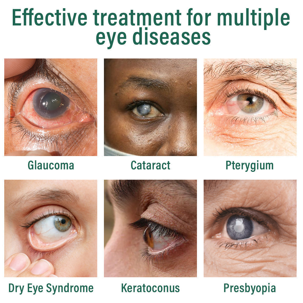 AQA™ Nano Eye Drops Serum 👩‍⚕️ Ophthal mologists Recommended (Suitable for presbyopia, dry eye syndrome, glaucoma, cataracts and diabetic retinopathy) 🍀