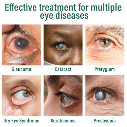 AQA™ Nano Eye Drops Serum 👩‍⚕️ Ophthal mologists Recommended (Suitable for presbyopia, dry eye syndrome, glaucoma, cataracts and diabetic retinopathy) 🍀