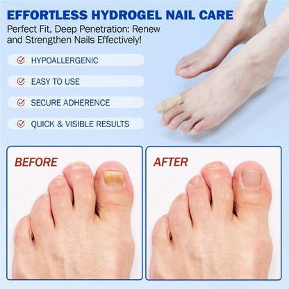 Fungal Nails? This Patch Solves It with Ease! ✅24pcs/box