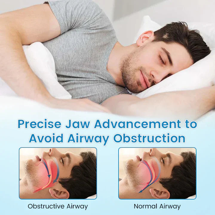 Adjustable Anti-Snoring Mouthpiece