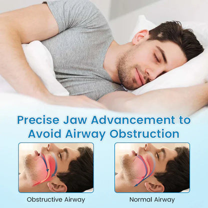 Adjustable Anti-Snoring Mouthpiece